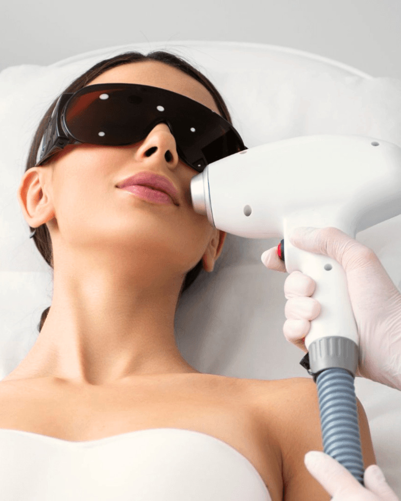 Laser Treatments