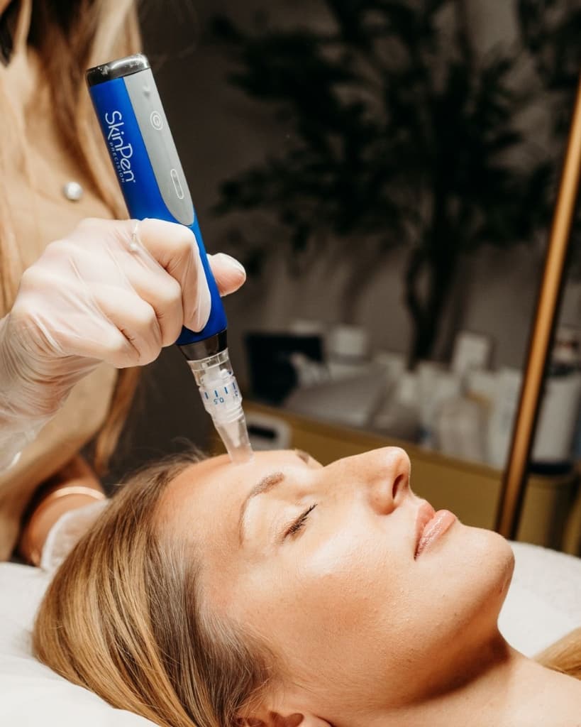 Microneedling