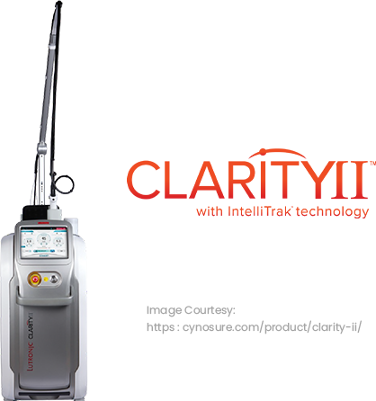 Clarity II Laser Hair Removal